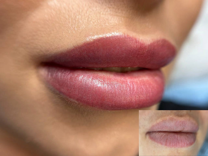 Lip micropigmentation